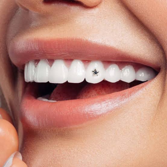 Teeth Jewellery in peshawar