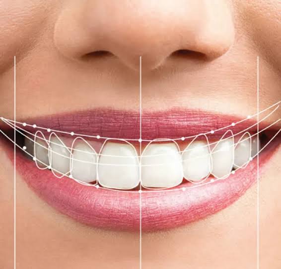 Smile Make Overs