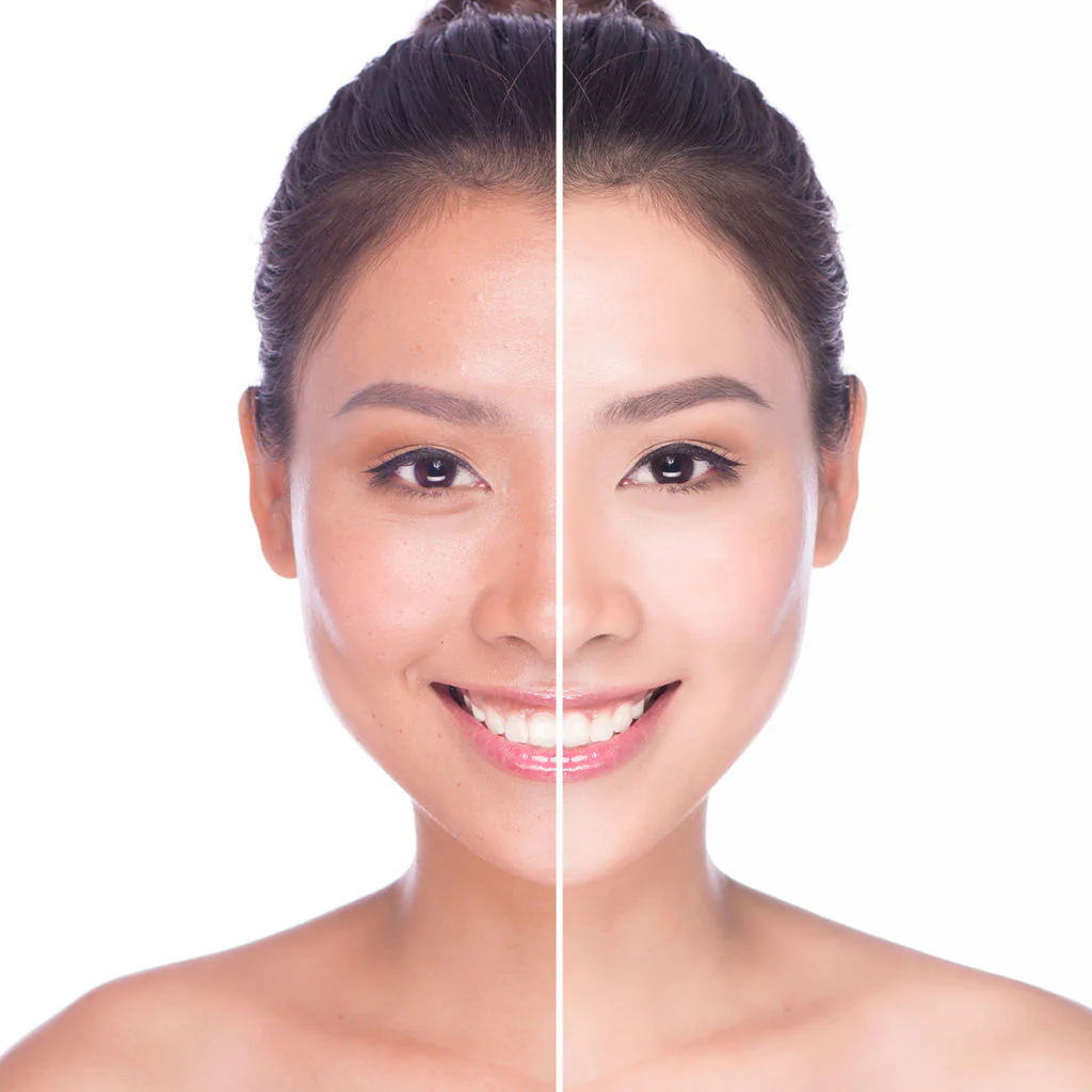 brighting skin